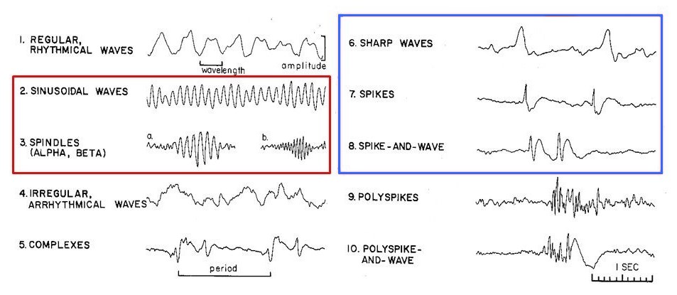 Types of EEG Waves